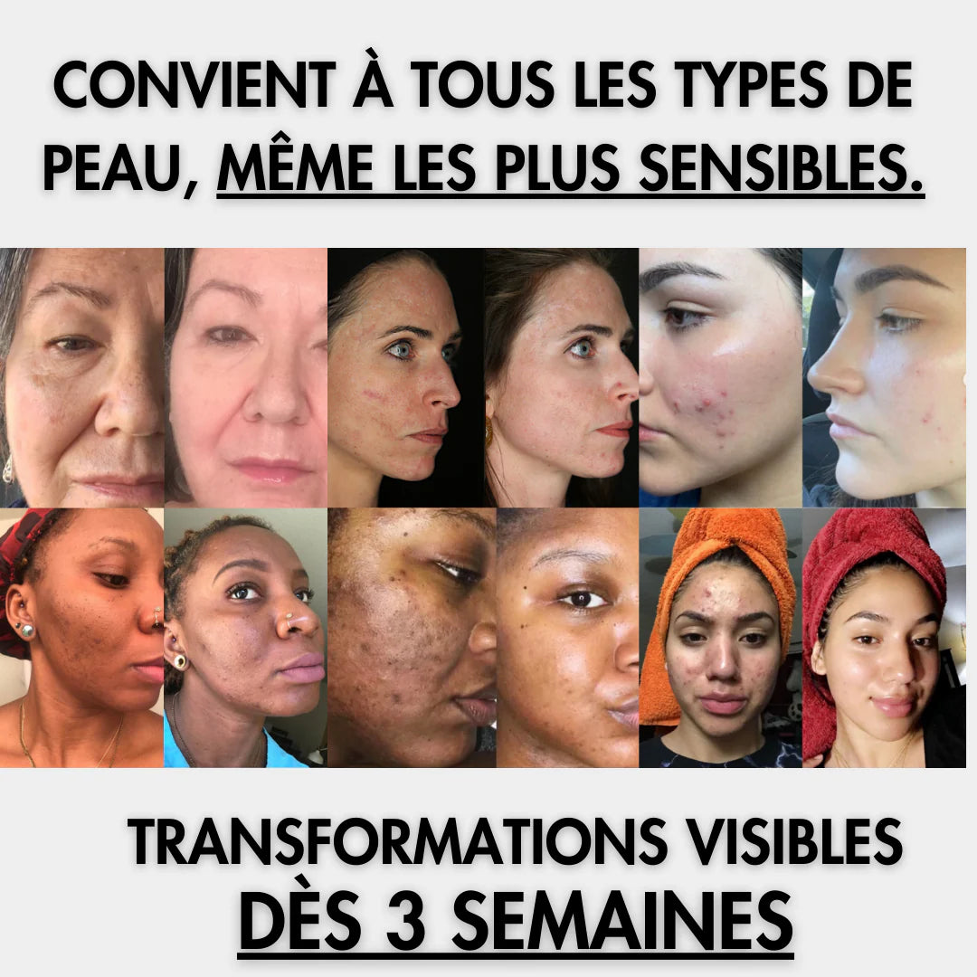 Cotons Nettoyants & Exfoliants Éclaircissants au Curcuma™