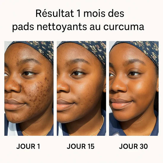 Cotons Nettoyants & Exfoliants Éclaircissants au Curcuma™