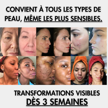 Cotons Nettoyants & Exfoliants Éclaircissants au Curcuma™